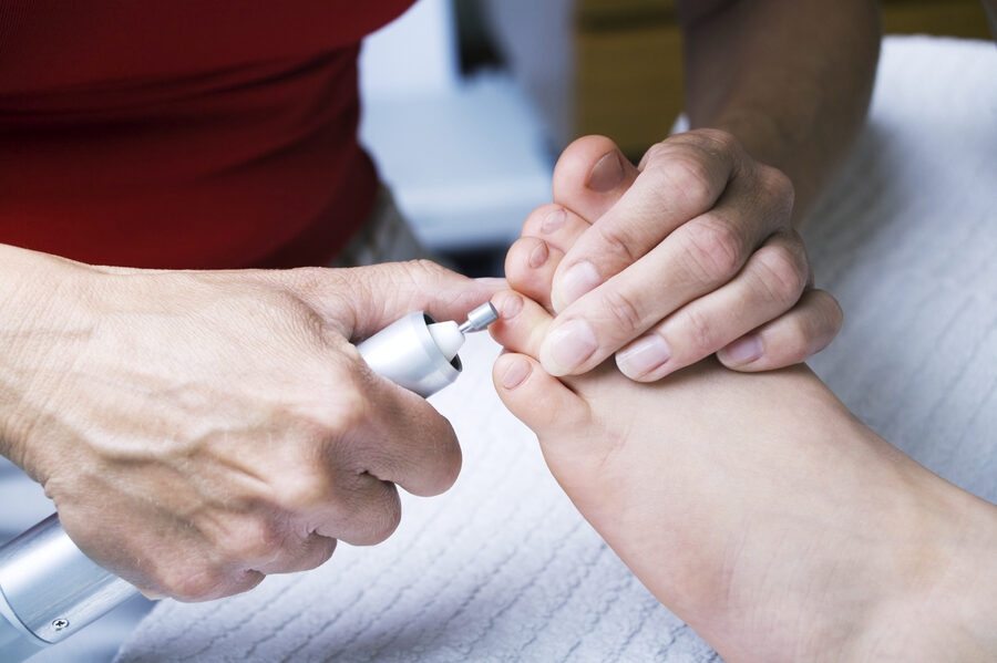 Podiatrist treating a patient's toenail